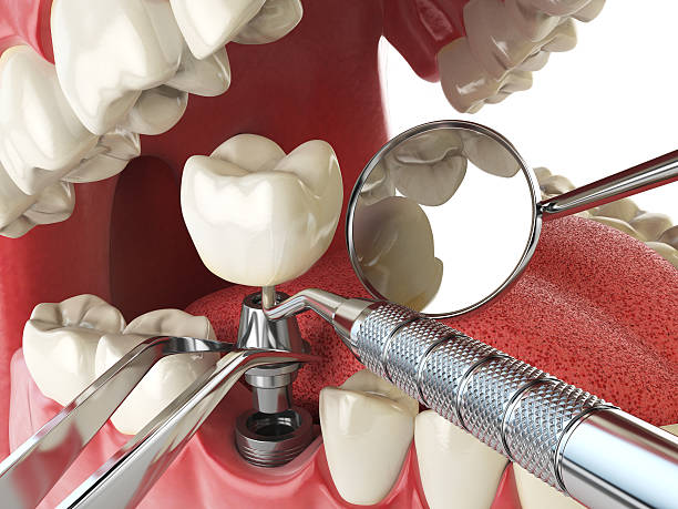 Best Emergency Cosmetic Dentistry (e.g., broken veneers) in Wesley Chapel, NC